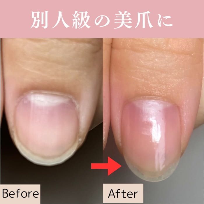 中野ネイルサロン｜爪トラブルネイルケア専門店｜シン｜深爪・割れ爪・欠け爪・二枚爪対応