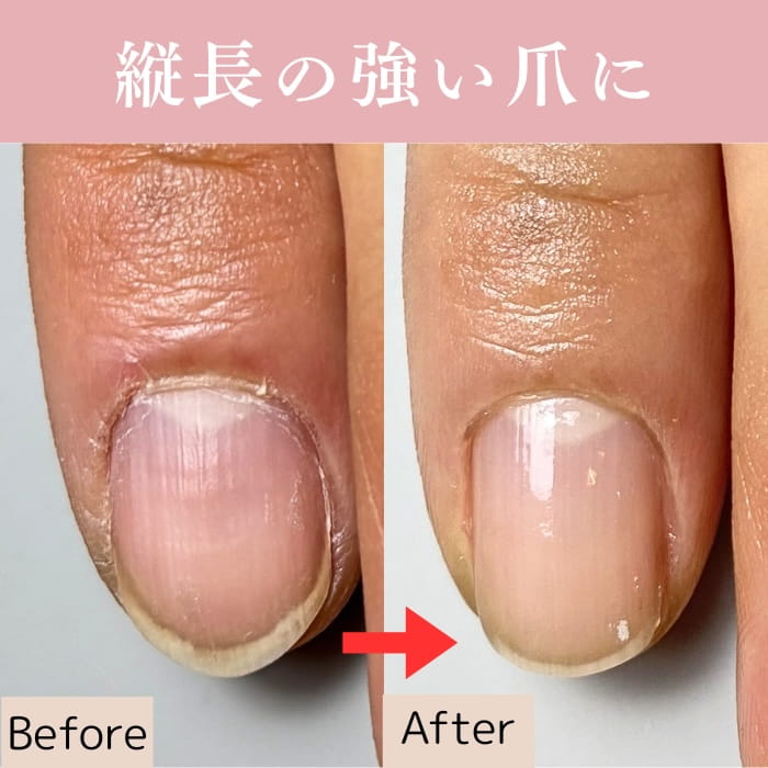 中野ネイルサロン｜爪トラブルネイルケア専門店｜シン｜深爪・割れ爪・欠け爪・二枚爪対応